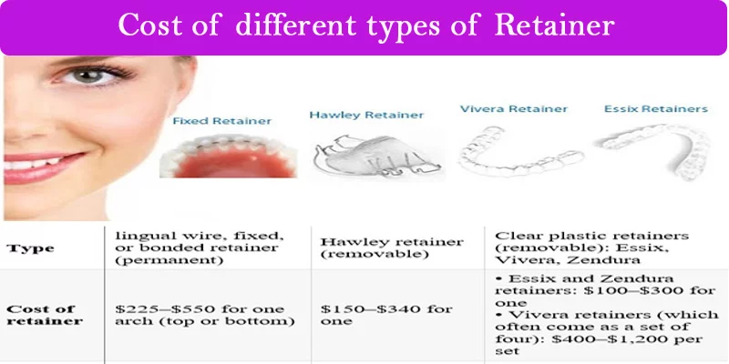 Cost of Retainer