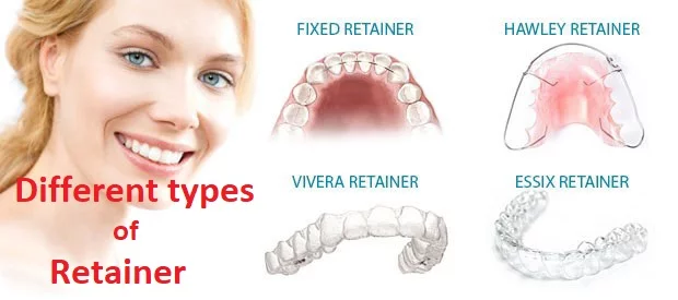 types of retainer